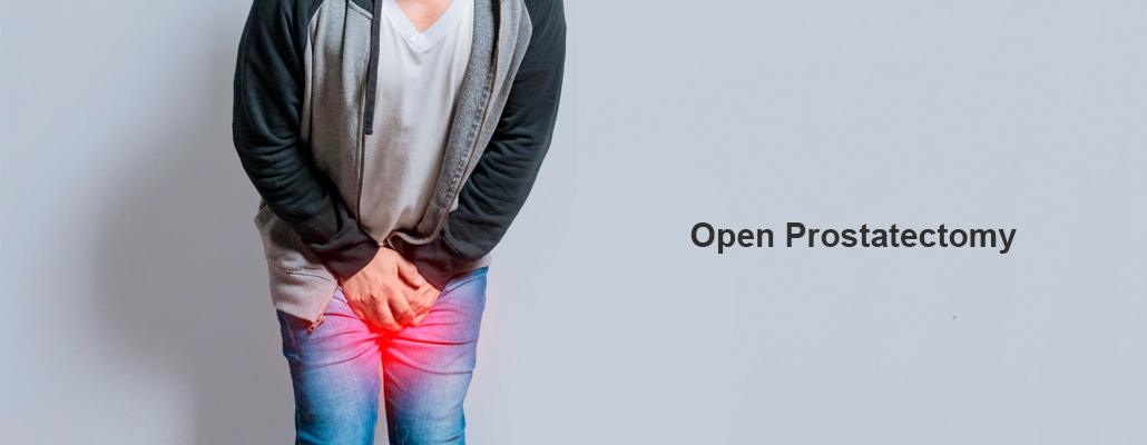 Best Open Prostatectomy Surgery Meerut