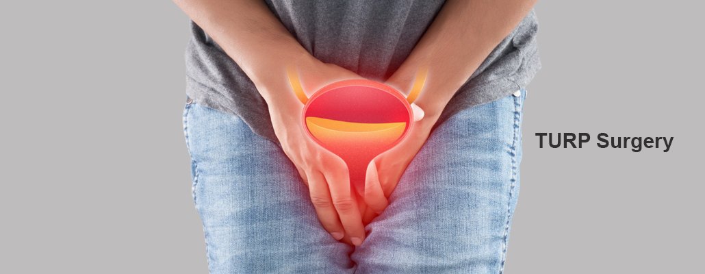 
Best TURP Surgery Meerut