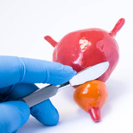 Best Urologist for TURP Meerut