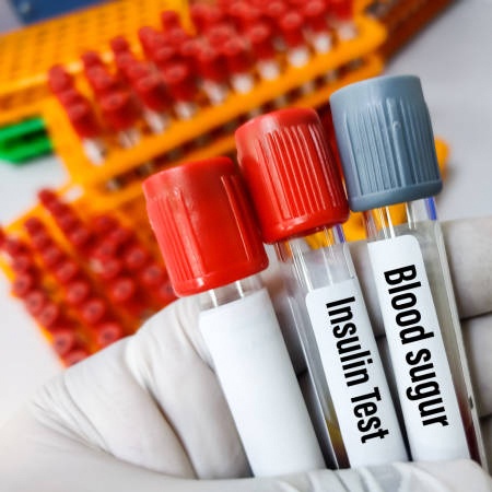 Diabetic Cystopathy Symptoms